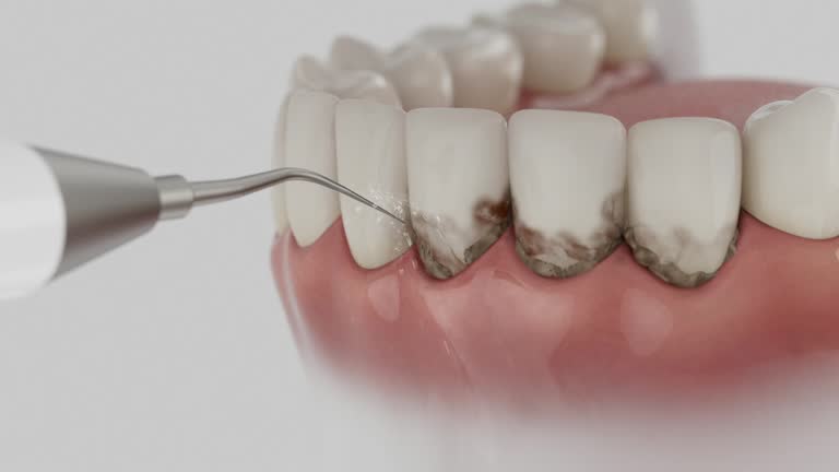 Trusted Tooth Extraction service in Livonia, MI - Dentist Open Now